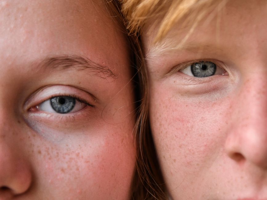 ¿Cuánto tarda en curar una conjuntivitis?
