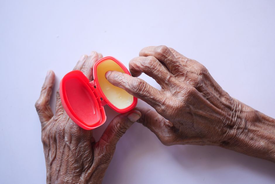 ¿Cuánto tarda en hacer efecto la crema antifúngica?